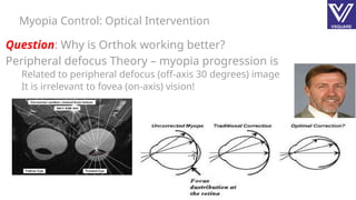 Off Center Vision Method Myopia Control Protocol optical intervention.pptx