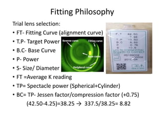 Fitting Philosophy
Trial lens selection:
• FT- Fitting Curve (alignment curve)
• T.P- Target Power
• B.C- Base Curve
• P- Power
• S- Size/ Diameter
• FT =Average K reading
• TP= Spectacle power (Spherical+Cylinder)
• BC= TP- Jessen factor/compression factor (+0.75)
(42.50-4.25)=38.25 → 337.5/38.25= 8.82
 