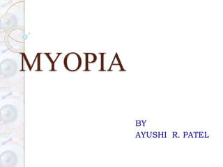 MYOPIA
BY
AYUSHI R. PATEL
 