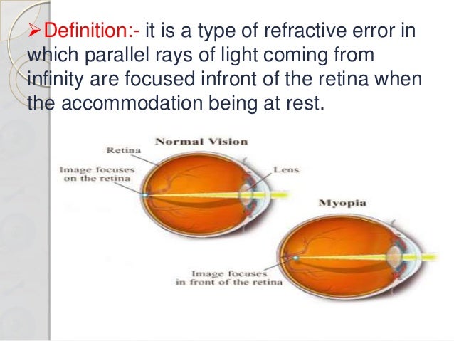 MYOPIA A REFRACTIVE ERROR OF AN EYE