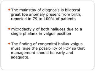 Microdactaly Myositis ossificans | PPT
