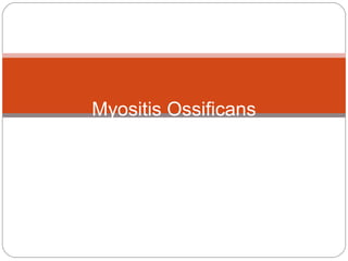 Myositis Ossificans
 