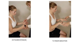C8 THUMB EXTENSION
T1 FINGER ABDUCTION
 