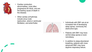 • Cardiac conduction
abnormalities, most often
progressive AV block, and are
the leading cause of death in
the disease.
• Other cardiac arrhythmias
include sinus node
dysfunction, atrial or ventricular
fibrillation, and atrial flutter. • Individuals with DM1 are at an
increased risk of developing
sleep apnea, commonly the
obstructive type.
• Patients with DM1 may have
central sleep apnea or even
narcolepsy.
• In addition to sleep-disordered
breathing, patients with more
advanced DM1 may have
daytime respiratory failure.
 