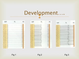 
Development….
Fig 2Fig 1 Fig 3
 