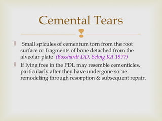 
 Small spicules of cementum torn from the root
surface or fragments of bone detached from the
alveolar plate (Bosshardt DD, Selvig KA 1977)
 If lying free in the PDL may resemble cementicles,
particularly after they have undergone some
remodeling through resorption & subsequent repair.
Cemental Tears
 