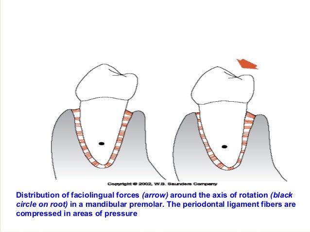 pdl periodontal ligament periodontal ligament