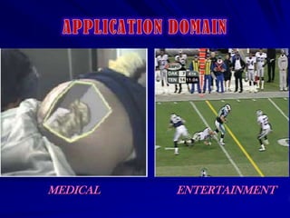 APPLICATION DOMAINMEDICALENTERTAINMENT