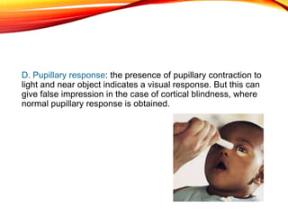 D. Pupillary response: the presence of pupillary contraction to
light and near object indicates a visual response. But this can
give false impression in the case of cortical blindness, where
normal pupillary response is obtained.
 