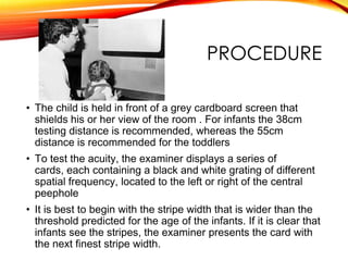 PROCEDURE
• The child is held in front of a grey cardboard screen that
shields his or her view of the room . For infants the 38cm
testing distance is recommended, whereas the 55cm
distance is recommended for the toddlers
• To test the acuity, the examiner displays a series of
cards, each containing a black and white grating of different
spatial frequency, located to the left or right of the central
peephole
• It is best to begin with the stripe width that is wider than the
threshold predicted for the age of the infants. If it is clear that
infants see the stripes, the examiner presents the card with
the next finest stripe width.
 