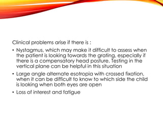 Clinical problems arise if there is :
• Nystagmus, which may make it difficult to assess when
the patient is looking towards the grating, especially if
there is a compensatory head posture. Testing in the
vertical plane can be helpful in this situation
• Large angle alternate esotropia with crossed fixation,
when it can be difficult to know to which side the child
is looking when both eyes are open
• Loss of interest and fatigue
 