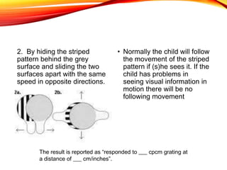 2. By hiding the striped
pattern behind the grey
surface and sliding the two
surfaces apart with the same
speed in opposite directions.
• Normally the child will follow
the movement of the striped
pattern if (s)he sees it. If the
child has problems in
seeing visual information in
motion there will be no
following movement
The result is reported as “responded to ___ cpcm grating at
a distance of ___ cm/inches”.
 