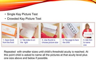 • Single Kay Picture Test
• Crowded Kay Picture Test
Repeated with smaller sizes until child’s threshold acuity is reached. At
this point child is asked to name all the pictures at that acuity level plus
one size above and below if possible.
 