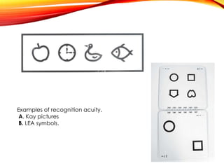 Examples of recognition acuity.
A. Kay pictures
B. LEA symbols.
 