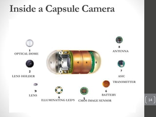 Inside a Capsule Camera
OPTICAL DOME
LENS HOLDER
LENS
ILLUMINATING LED’S CMOS IMAGE SENSOR
BATTERY
ASIC
TRANSMITTER
ANTENNA
14
 