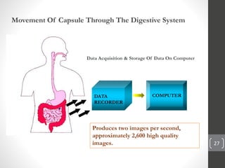 27
Movement Of Capsule Through The Digestive System
DATA
RECORDER
COMPUTER
Data Acquisition & Storage Of Data On Computer
Produces two images per second,
approximately 2,600 high quality
images.
 