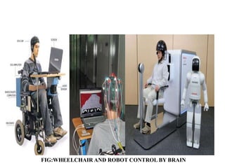 FIG:WHEELCHAIR AND ROBOT CONTROL BY BRAIN
 