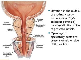 Elevation in the middle
of urethral crest –
‘verumontanum’ (a/k
colliculus seminalis) –
contains slit like orifice
of prostatic utricle.
Openings of
ejaculatory ducts are
present on either side
of this orifice.
 