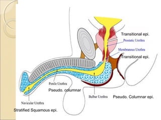 Transitional epi.
Transitional epi.
Pseudo. Columnar epi.
Pseudo. columnar
Stratified Squamous epi.
 