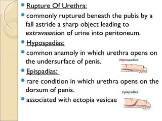 Rupture Of Urethra:
commonly ruptured beneath the pubis by a
fall astride a sharp object leading to
extravasation of urine into peritoneum.
Hypospadias:
common anamoly in which urethra opens on
the undersurface of penis.
Epispadias:
rare condition in which urethra opens on the
dorsum of penis.
associated with ectopia vesicae
 