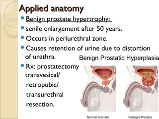 Applied anatomyApplied anatomy
Benign prostate hypertrophy:
senile enlargement after 50 years.
Occurs in periurethral zone.
Causes retention of urine due to distortion
of urethra.
Rx: prostatectomy – transvesical
transvesical/
retropubic/
transurethral
resection.
 