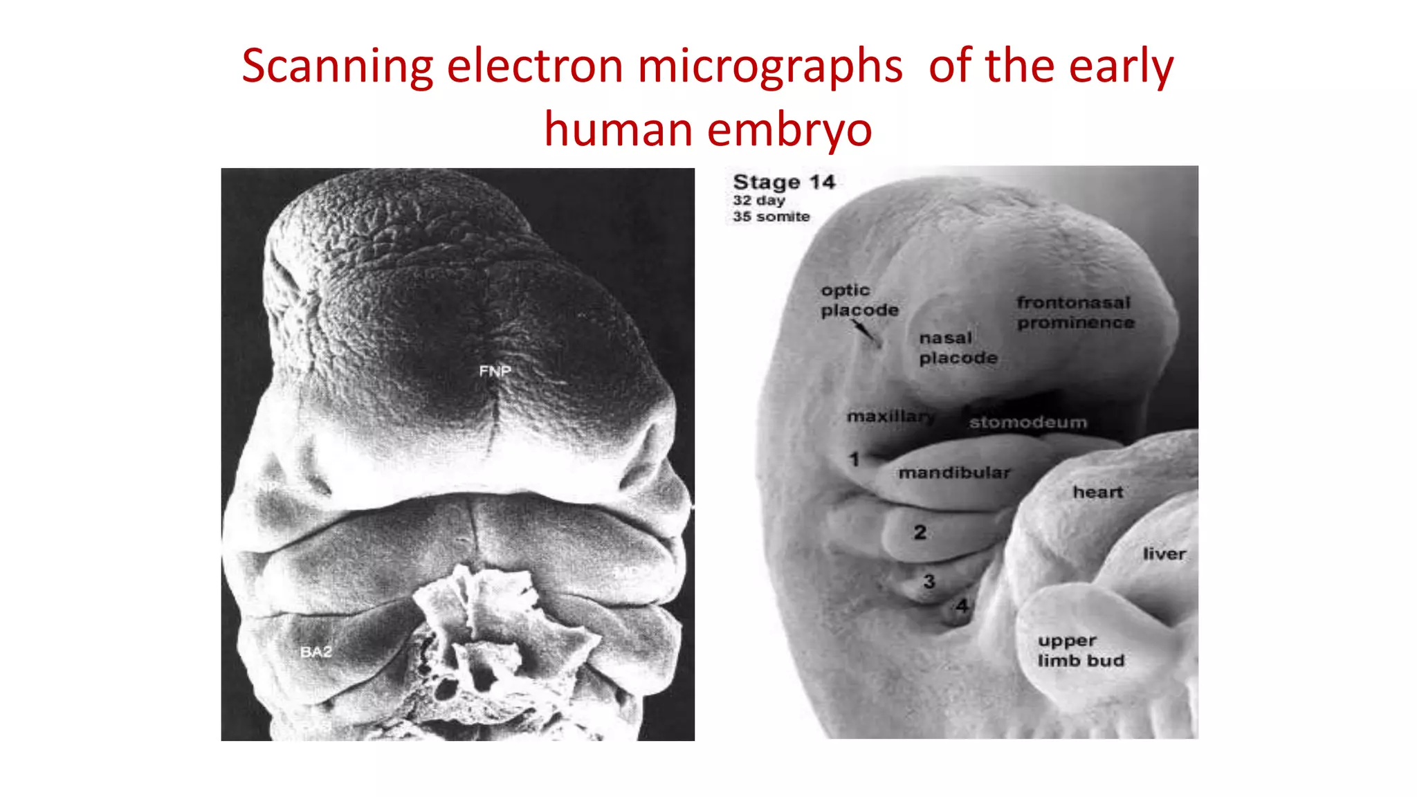 Scanning electron micrographs of the early
human embryo
 
