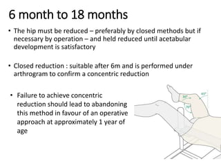6 month to 18 months
• The hip must be reduced – preferably by closed methods but if
necessary by operation – and held reduced until acetabular
development is satisfactory
• Closed reduction : suitable after 6m and is performed under
arthrogram to confirm a concentric reduction
• Failure to achieve concentric
reduction should lead to abandoning
this method in favour of an operative
approach at approximately 1 year of
age
 