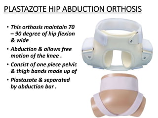 PLASTAZOTE HIP ABDUCTION ORTHOSIS
• This orthosis maintain 70
– 90 degree of hip flexion
& wide
• Abduction & allows free
motion of the knee .
• Consist of one piece pelvic
& thigh bands made up of
• Plastazote & separated
by abduction bar .
 