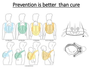 Prevention is better than cure
 