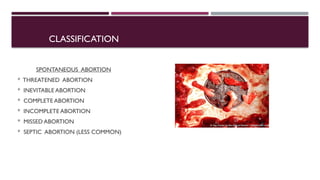 Abortion its types and treatment methods | PPTX