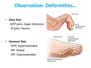 Observation- Deformities…
• Claw Toes
MTP joint- Hyper Extension
IP joint- Flexion
• Hammer Toes
MTP- Hyperextended
PIP- Flexed
DIP- Hyperextended
 