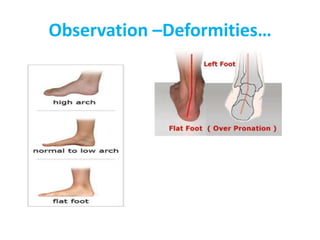Observation –Deformities…
 