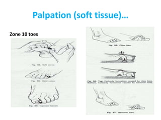 Palpation (soft tissue)…
Zone 10 toes
 