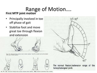Range of Motion….
First MTP joint motion
• Principally involved in toe
off phase of gait
• Stabilize foot and move
great toe through flexion
and extension
 