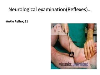 Neurological examination(Reflexes)…
Ankle Reflex, S1
 