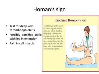 Homan’s sign
• Test for deep vein
thrombhophlebitis
• Forcibly dorsiflex ankle
with leg in extension
• Pain in calf muscle
 