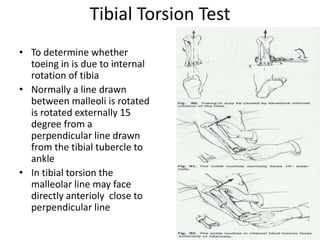 Tibial Torsion Test
• To determine whether
toeing in is due to internal
rotation of tibia
• Normally a line drawn
between malleoli is rotated
is rotated externally 15
degree from a
perpendicular line drawn
from the tibial tubercle to
ankle
• In tibial torsion the
malleolar line may face
directly anterioly close to
perpendicular line
 