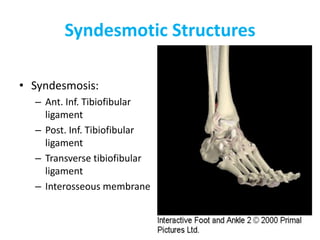 Syndesmotic Structures
• Syndesmosis:
– Ant. Inf. Tibiofibular
ligament
– Post. Inf. Tibiofibular
ligament
– Transverse tibiofibular
ligament
– Interosseous membrane
 