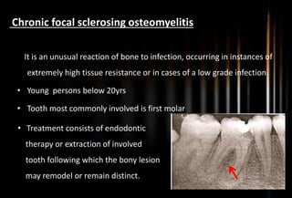 Chronic focal sclerosing osteomyelitis
It It is an unusual reaction of bone to infection, occurring in instances of
extremely high tissue resistance or in cases of a low grade infection.
• Young persons below 20yrs
• Tooth most commonly involved is first molar
• Treatment consists of endodontic
therapy or extraction of involved
tooth following which the bony lesion
may remodel or remain distinct.
 