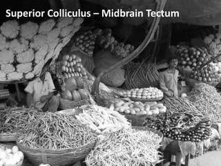 AttentionLimited Processing