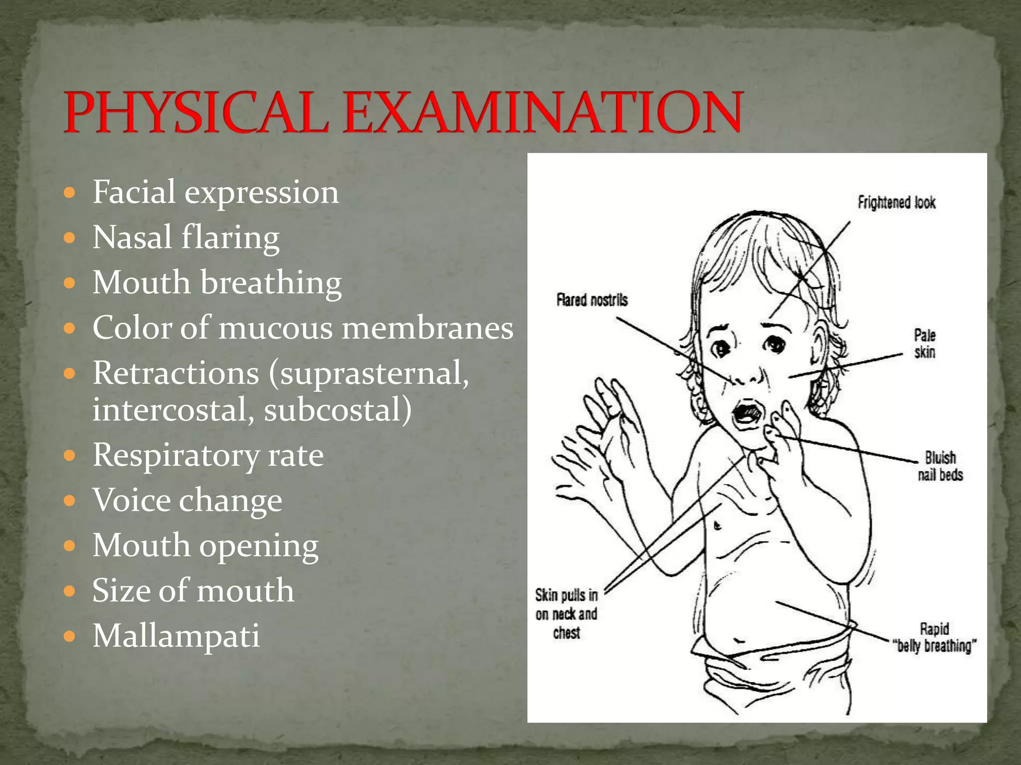  Facial expression
 Nasal flaring
 Mouth breathing
 Color of mucous membranes
 Retractions (suprasternal,
intercostal, subcostal)
 Respiratory rate
 Voice change
 Mouth opening
 Size of mouth
 Mallampati
 