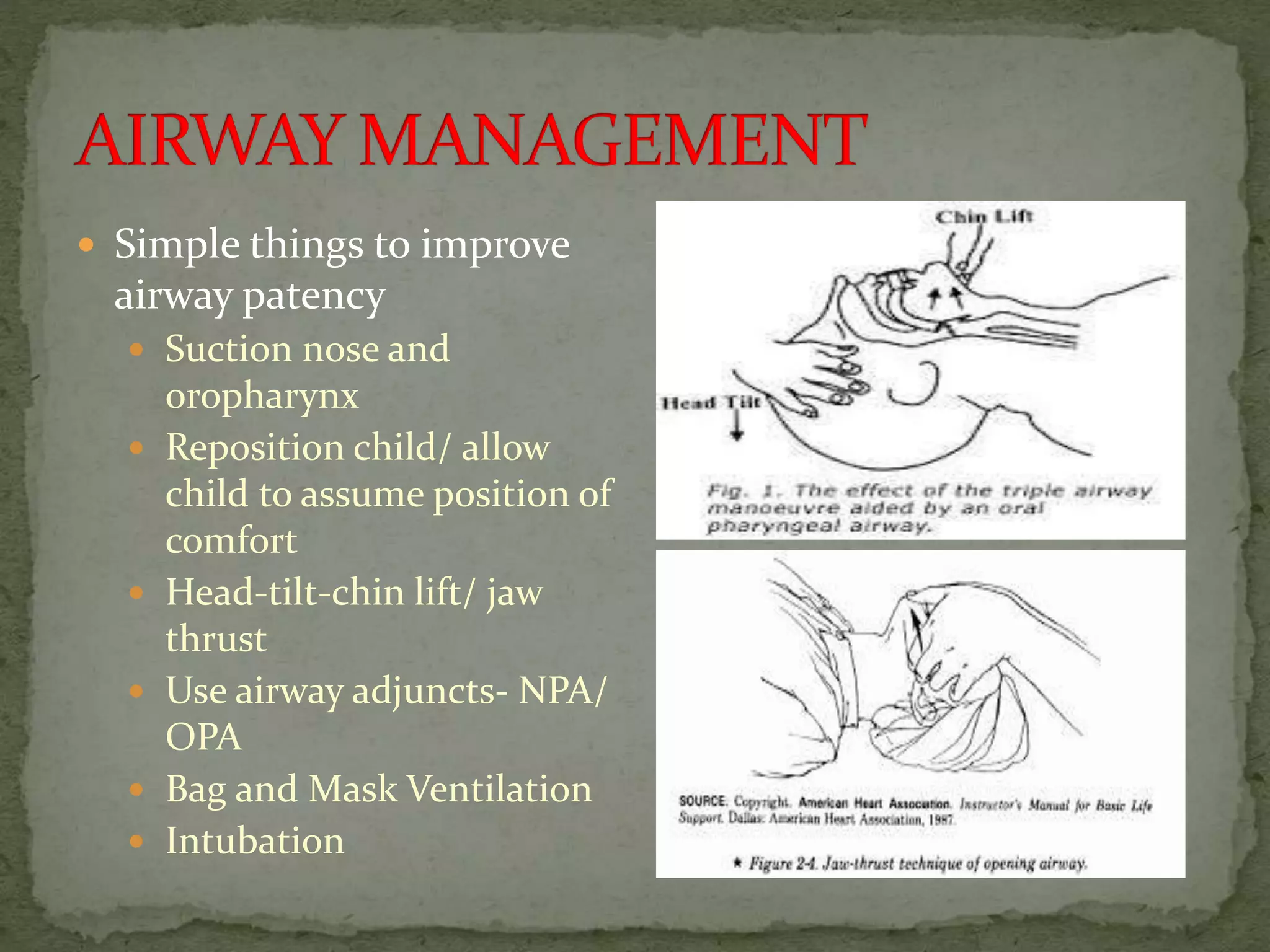  Simple things to improve
airway patency
 Suction nose and
oropharynx
 Reposition child/ allow
child to assume position of
comfort
 Head-tilt-chin lift/ jaw
thrust
 Use airway adjuncts- NPA/
OPA
 Bag and Mask Ventilation
 Intubation
 