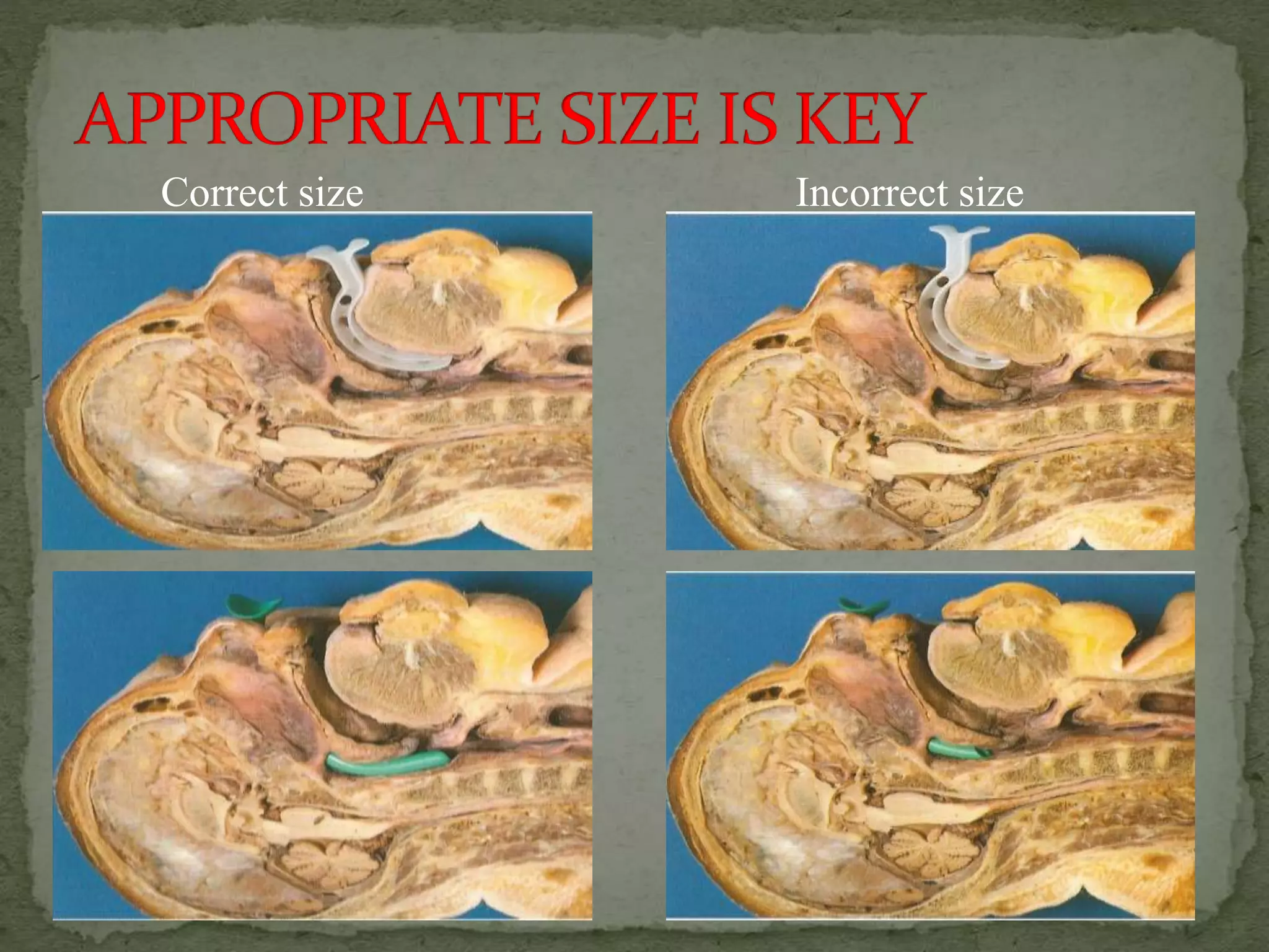 Correct size Incorrect size
 