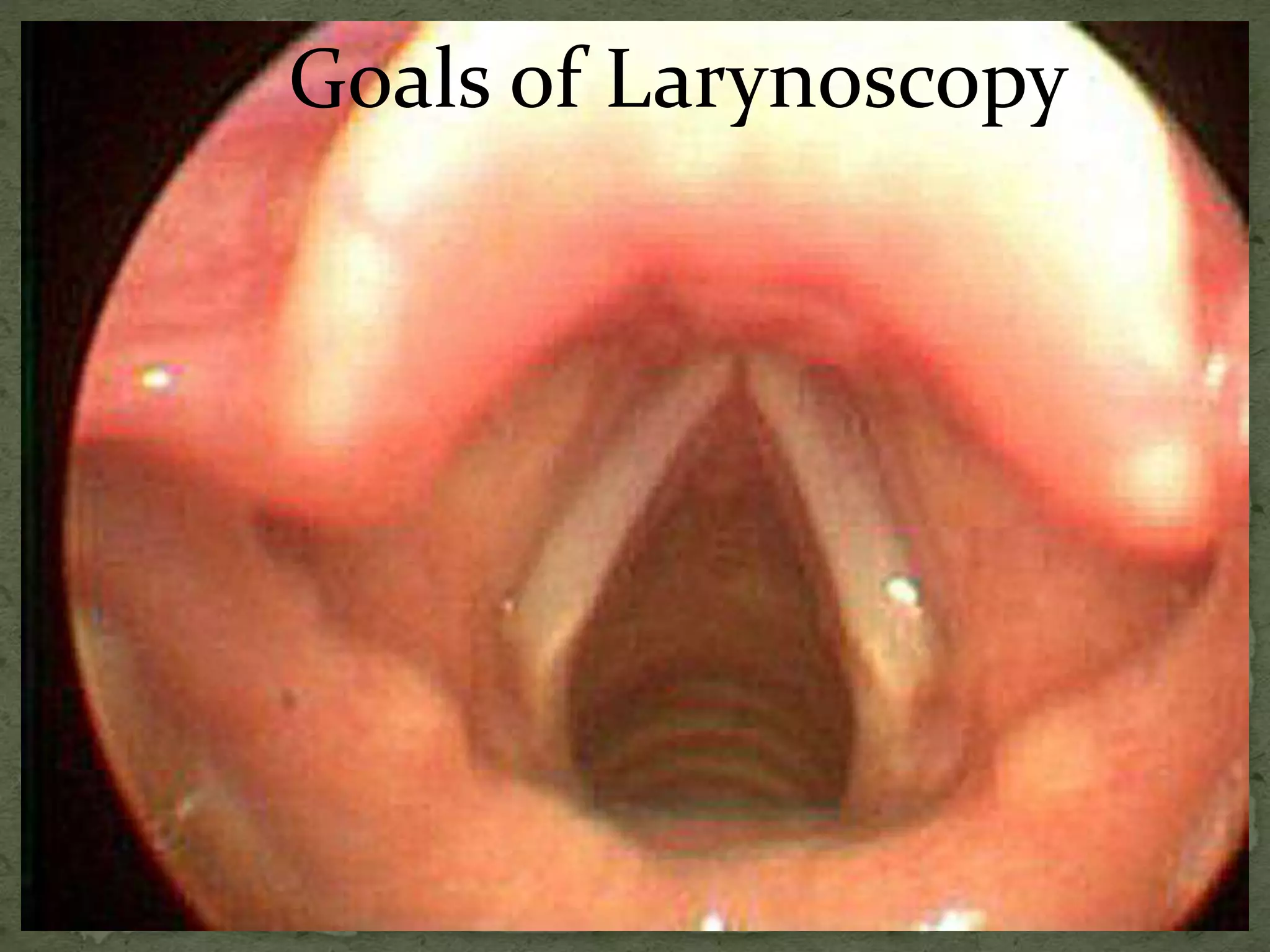 Goals of Larynoscopy
 