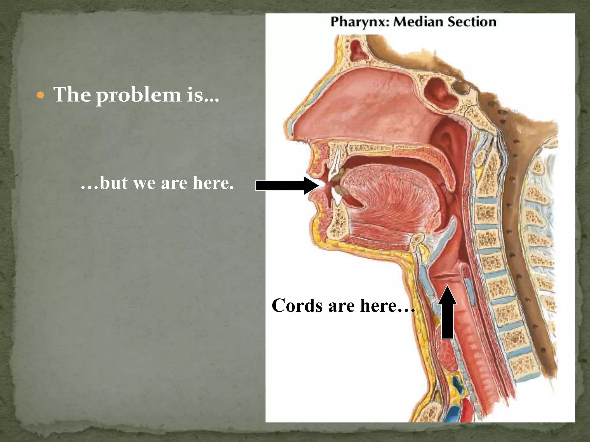  The problem is…
…but we are here.
Cords are here…
 