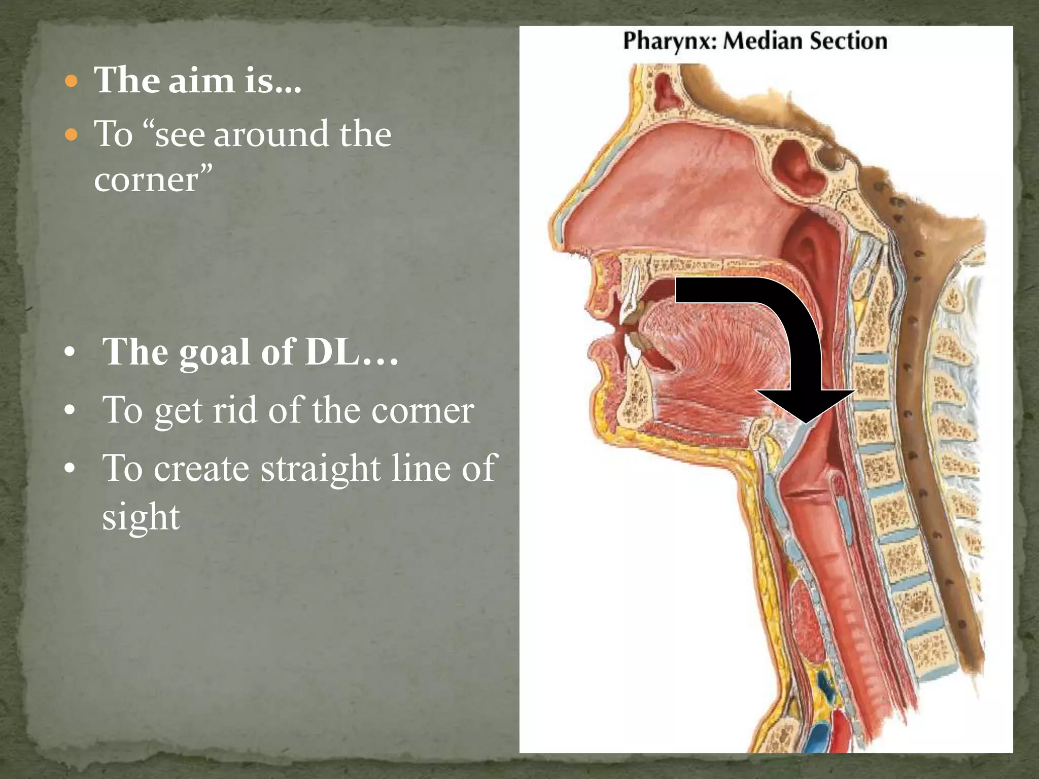  The aim is…
 To “see around the
corner”
• The goal of DL…
• To get rid of the corner
• To create straight line of
sight
 