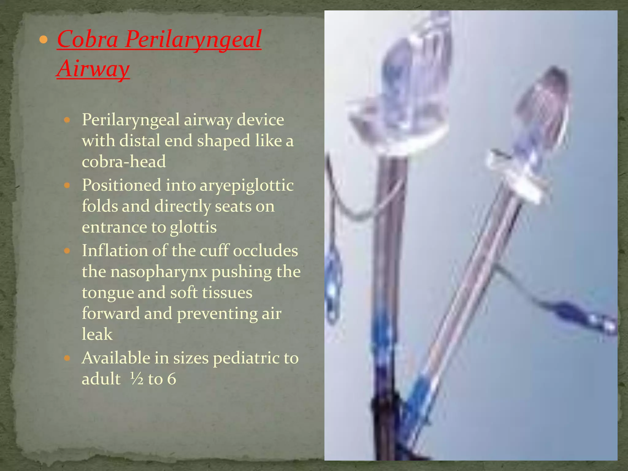  Cobra Perilaryngeal
Airway
 Perilaryngeal airway device
with distal end shaped like a
cobra-head
 Positioned into aryepiglottic
folds and directly seats on
entrance to glottis
 Inflation of the cuff occludes
the nasopharynx pushing the
tongue and soft tissues
forward and preventing air
leak
 Available in sizes pediatric to
adult ½ to 6
 