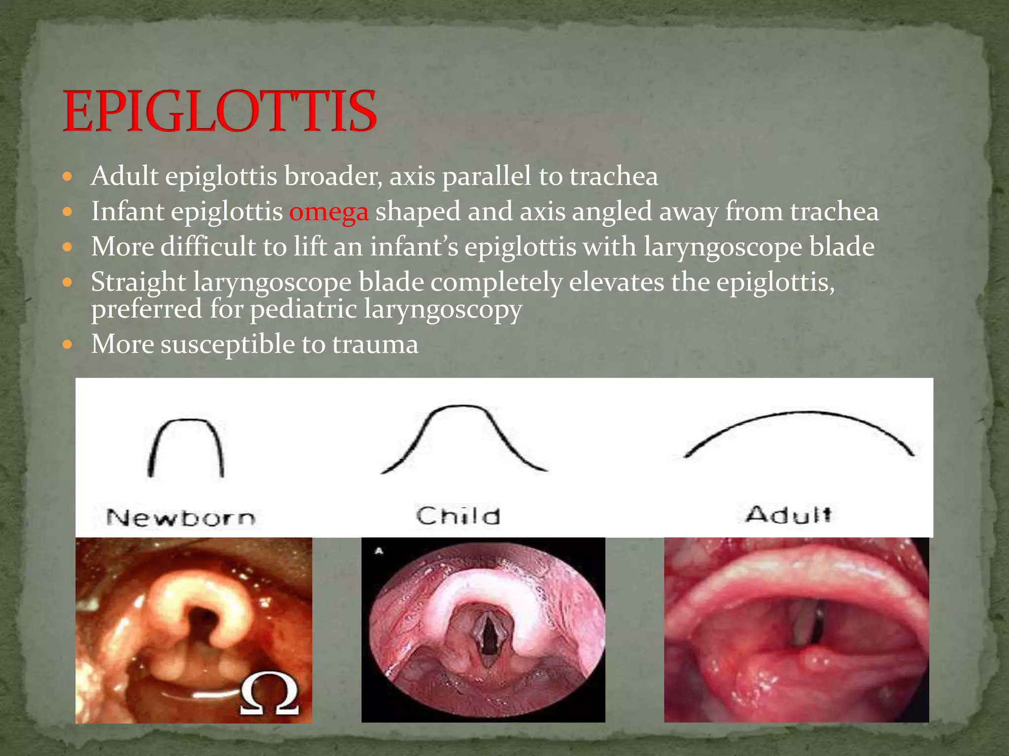  Adult epiglottis broader, axis parallel to trachea
 Infant epiglottis omega shaped and axis angled away from trachea
 More difficult to lift an infant’s epiglottis with laryngoscope blade
 Straight laryngoscope blade completely elevates the epiglottis,
preferred for pediatric laryngoscopy
 More susceptible to trauma
 