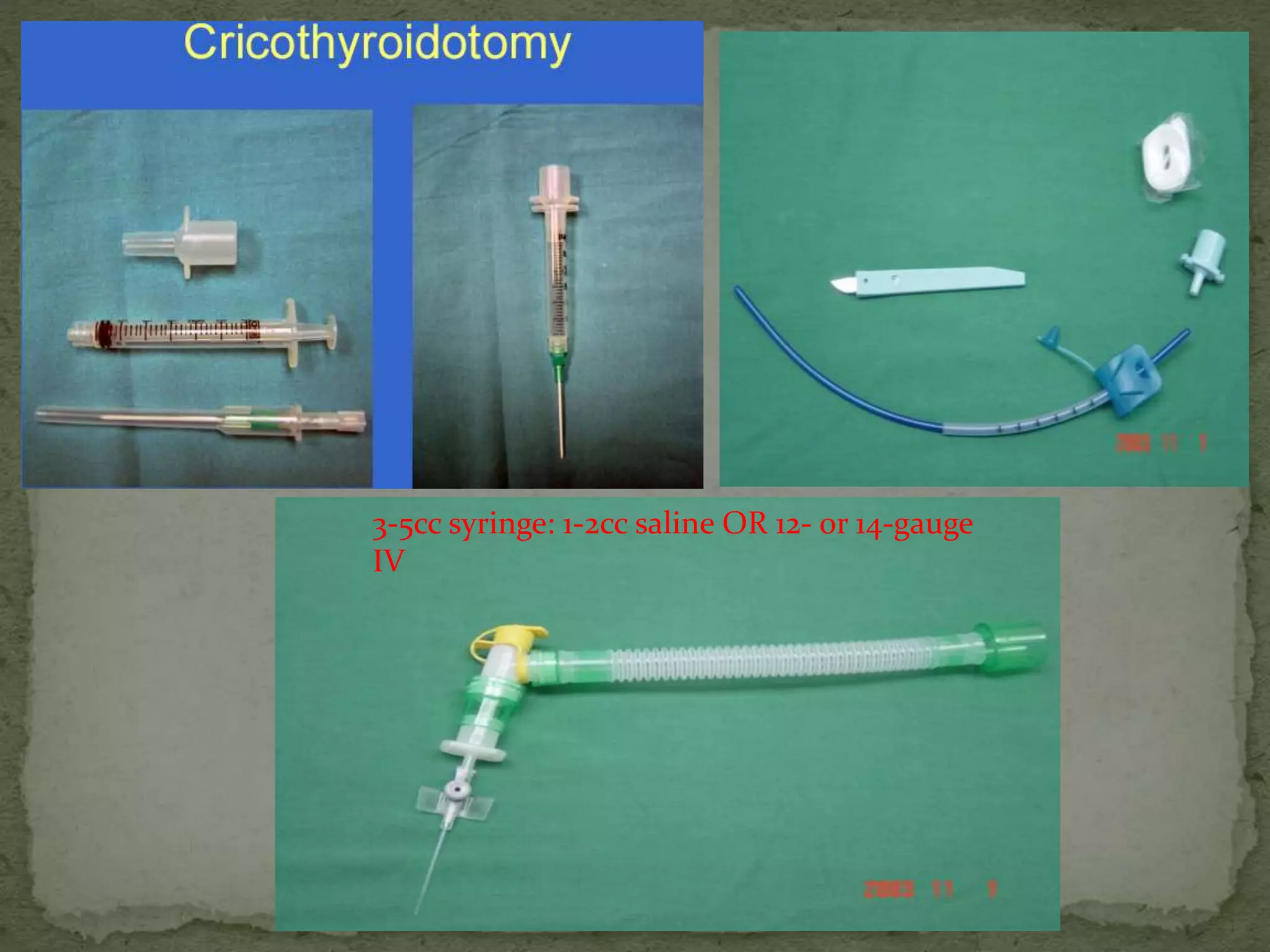 3-5cc syringe: 1-2cc saline OR 12- or 14-gauge
IV
 