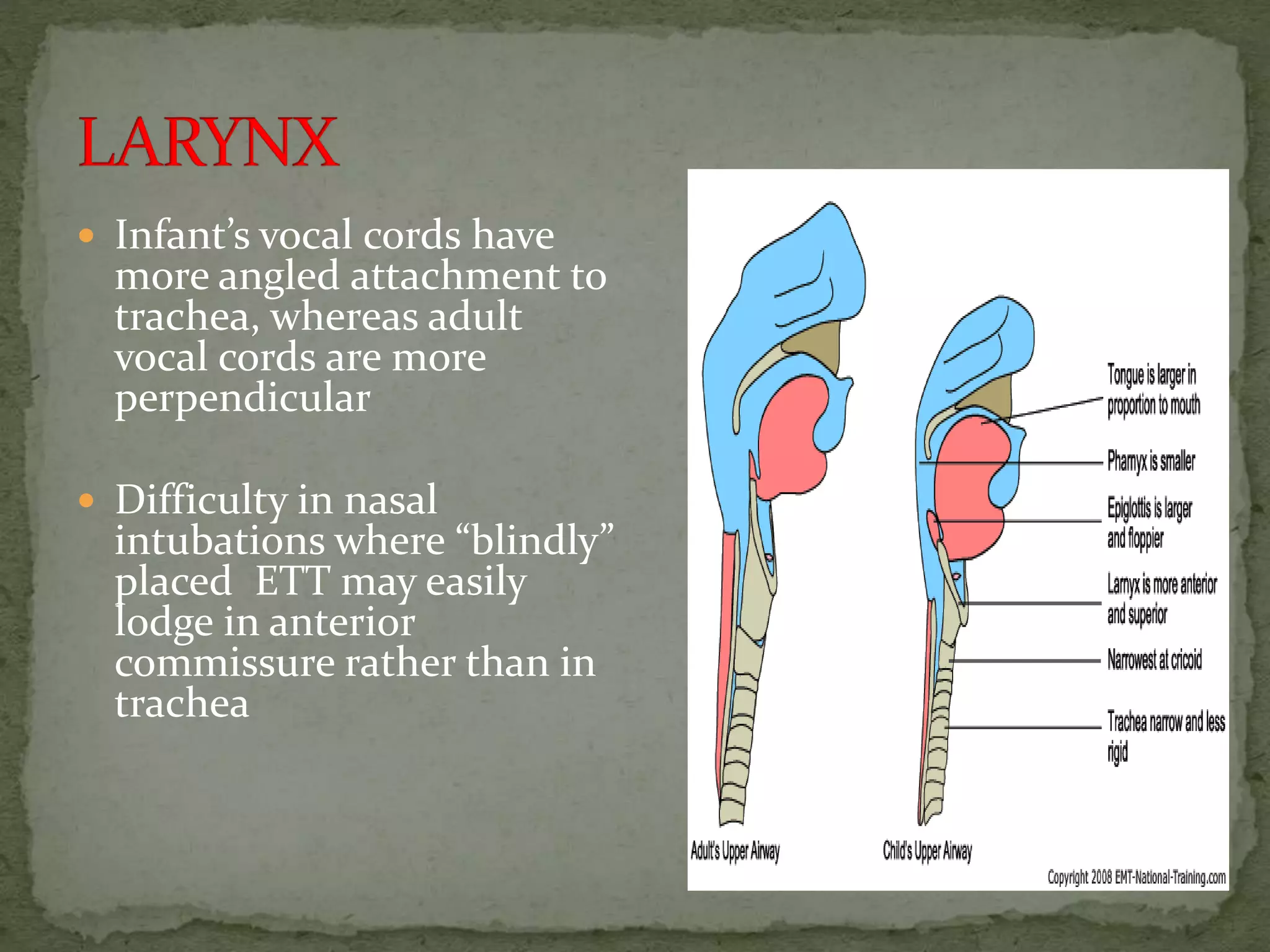  Infant’s vocal cords have
more angled attachment to
trachea, whereas adult
vocal cords are more
perpendicular
 Difficulty in nasal
intubations where “blindly”
placed ETT may easily
lodge in anterior
commissure rather than in
trachea
 